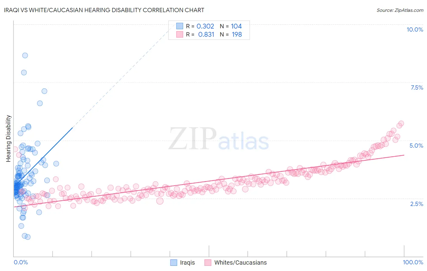Iraqi vs White/Caucasian Hearing Disability