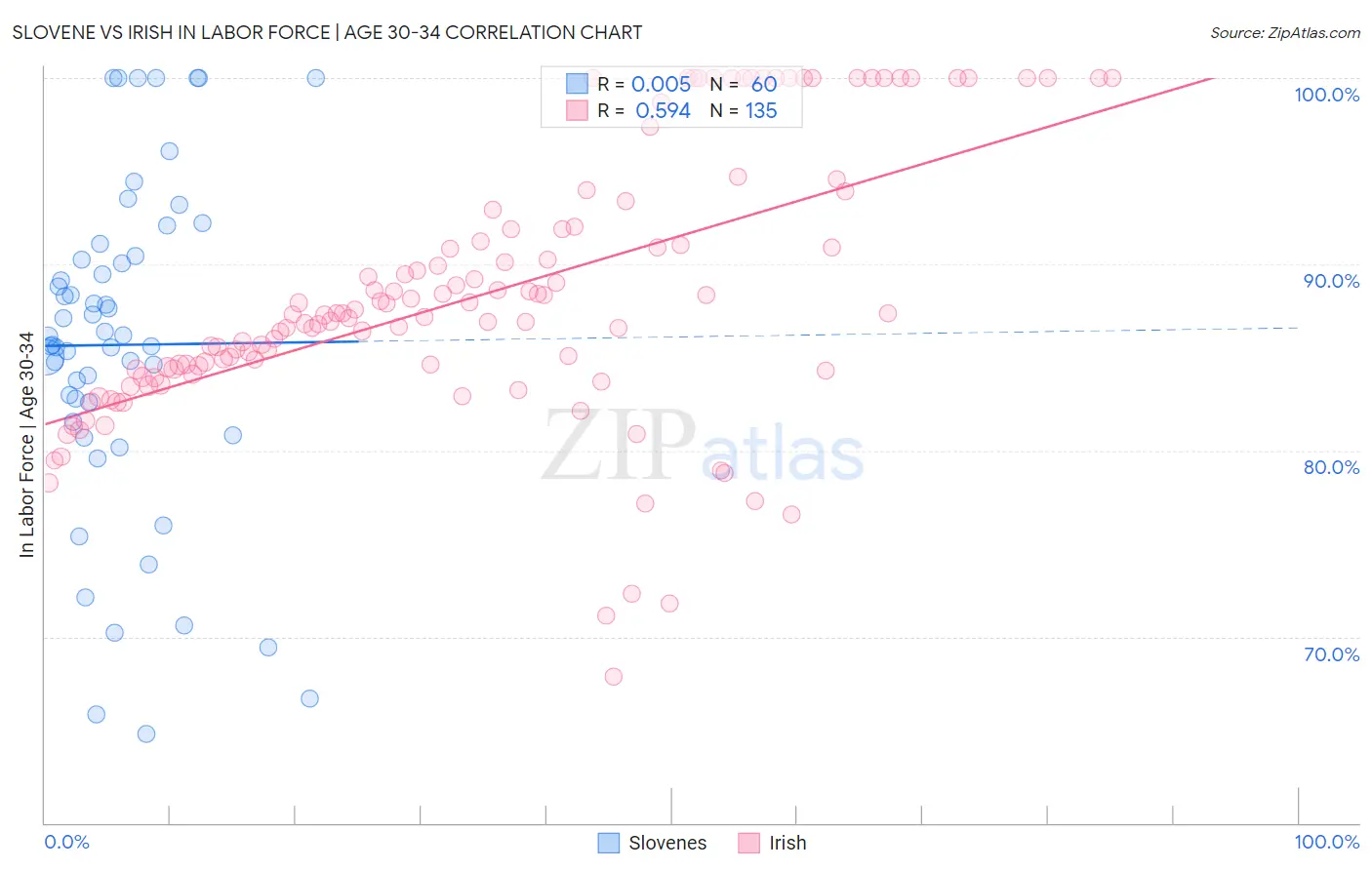 Slovene vs Irish In Labor Force | Age 30-34
