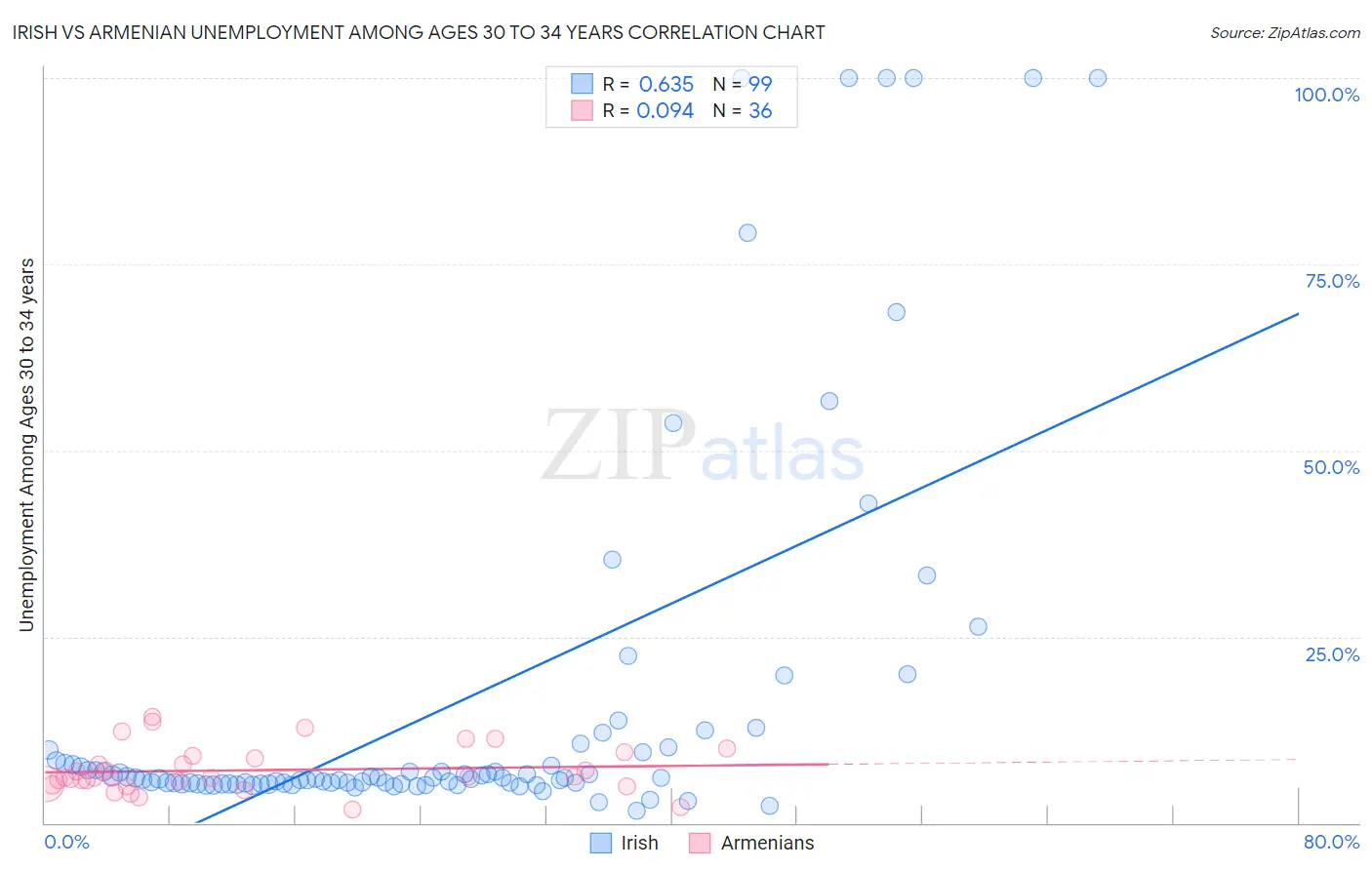 Irish vs Armenian Unemployment Among Ages 30 to 34 years