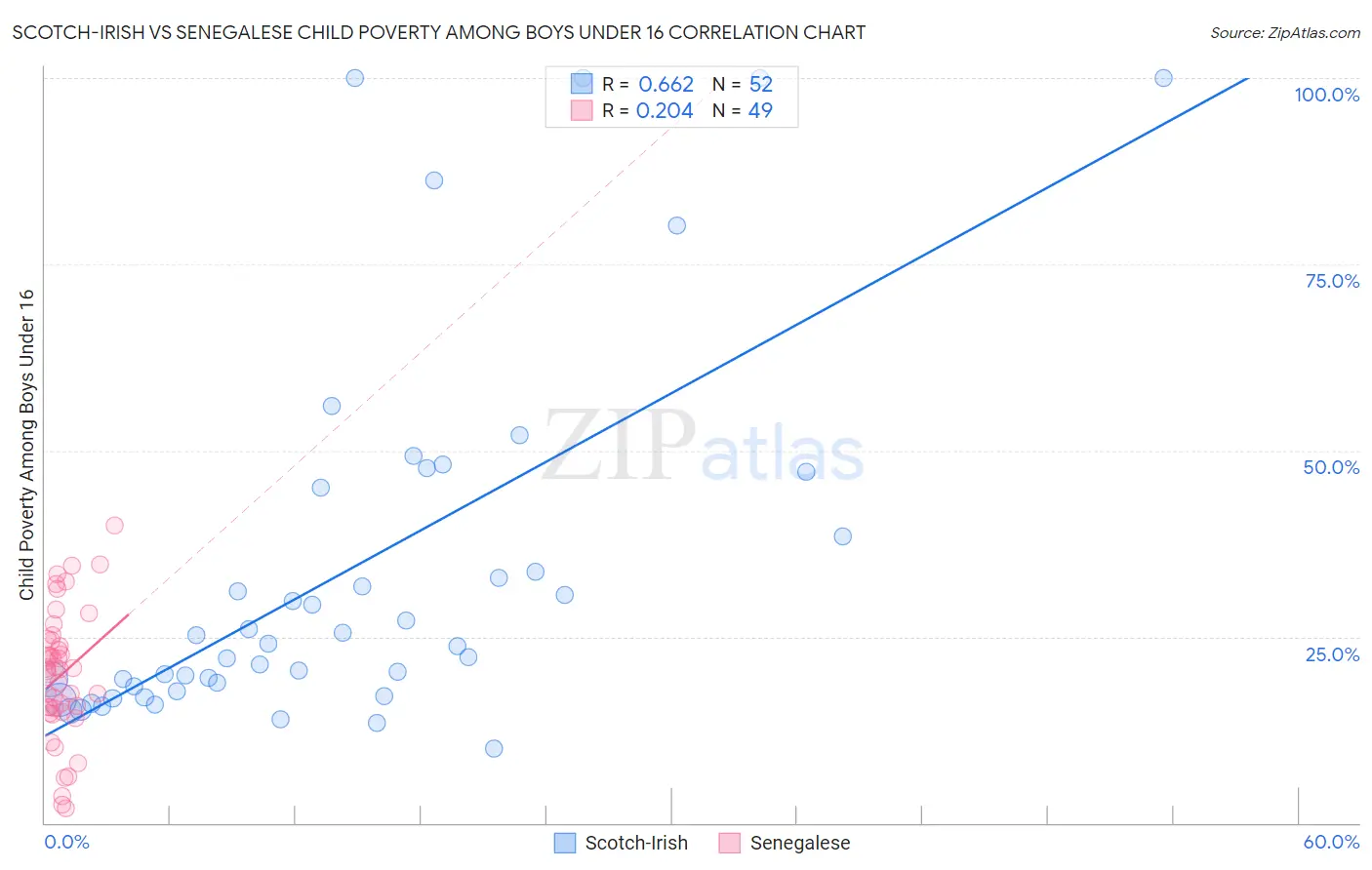 Scotch-Irish vs Senegalese Child Poverty Among Boys Under 16