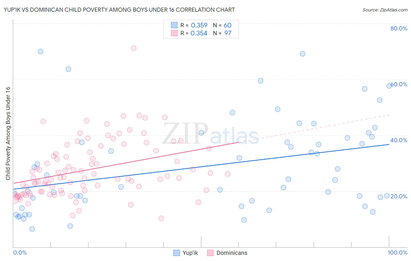 Yup'ik vs Dominican Child Poverty Among Boys Under 16