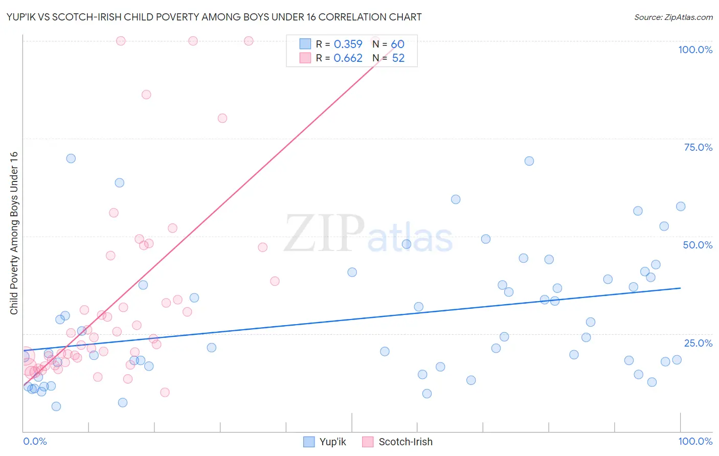 Yup'ik vs Scotch-Irish Child Poverty Among Boys Under 16