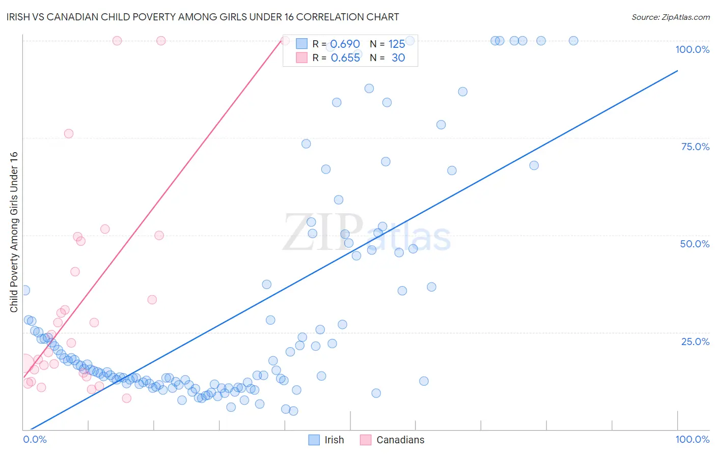 Irish vs Canadian Child Poverty Among Girls Under 16