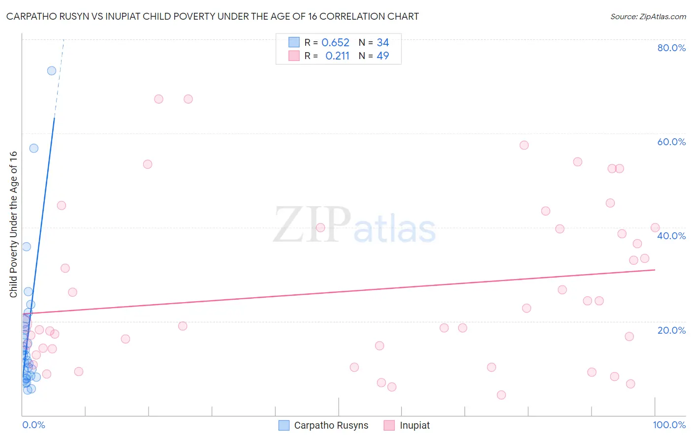 Carpatho Rusyn vs Inupiat Child Poverty Under the Age of 16