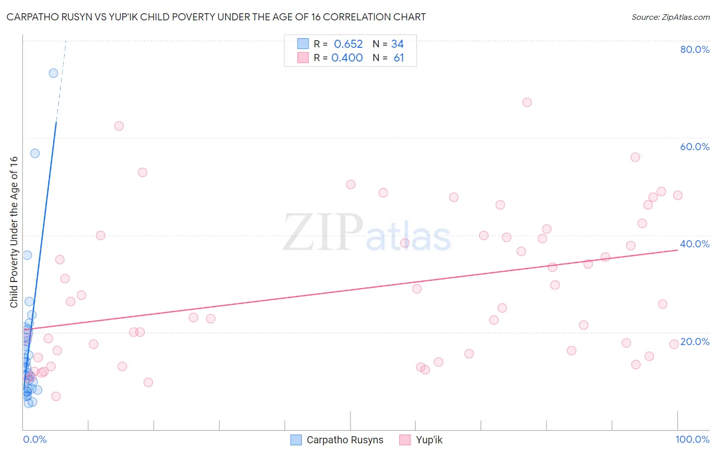 Carpatho Rusyn vs Yup'ik Child Poverty Under the Age of 16