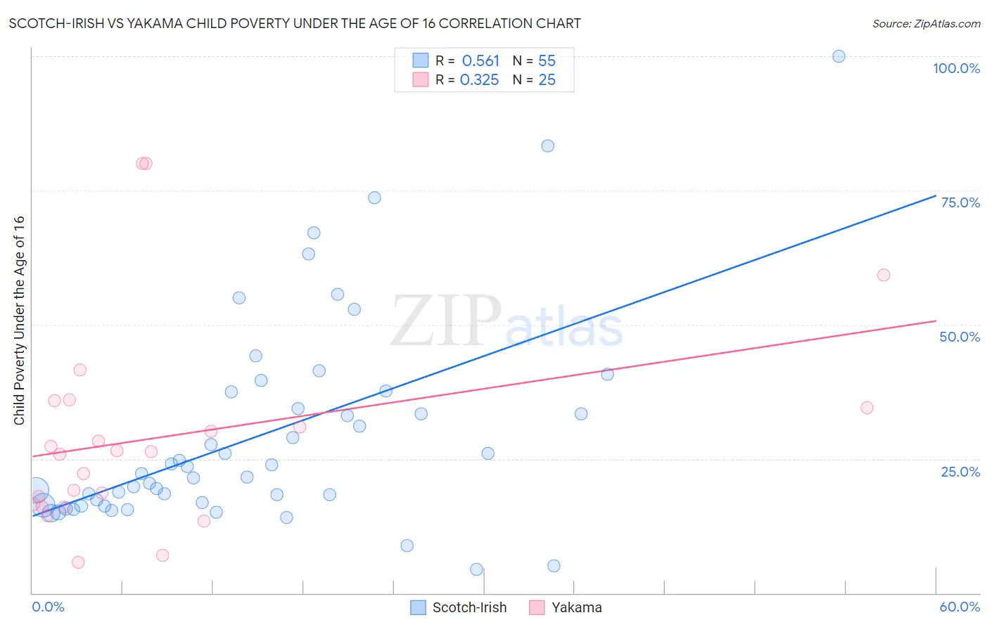 Scotch-Irish vs Yakama Child Poverty Under the Age of 16