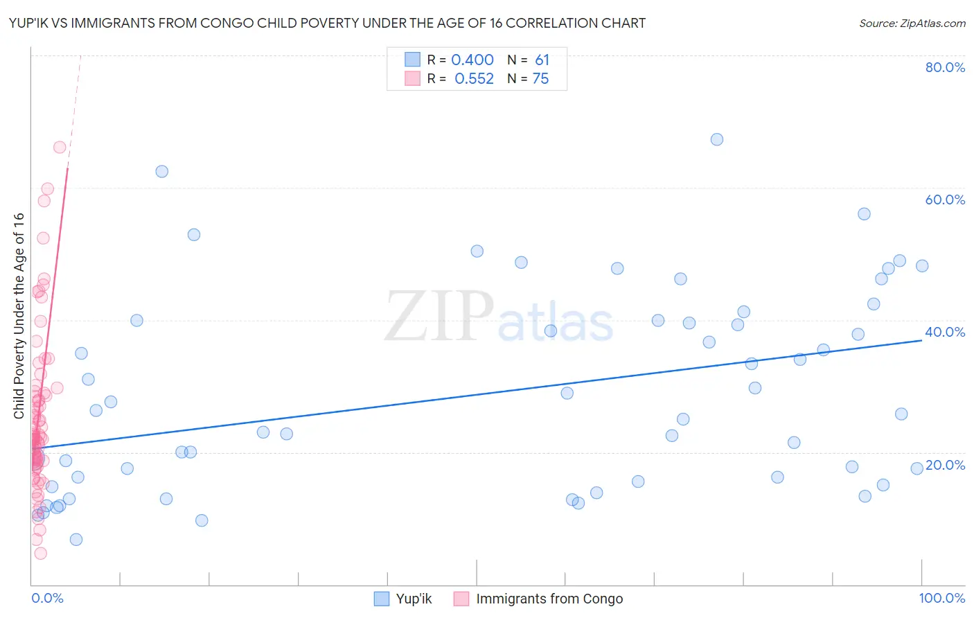 Yup'ik vs Immigrants from Congo Child Poverty Under the Age of 16