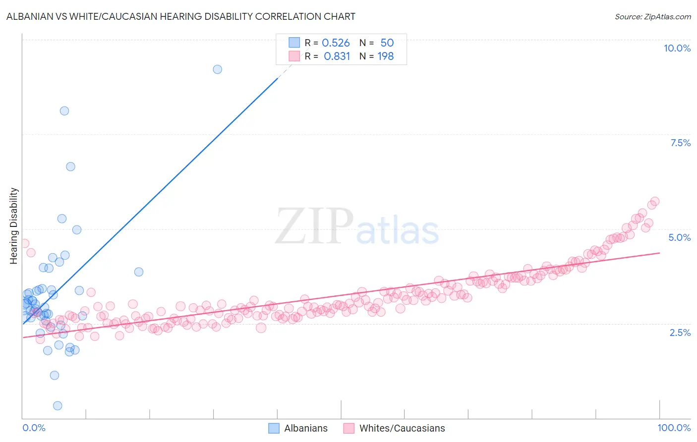 Albanian vs White/Caucasian Hearing Disability