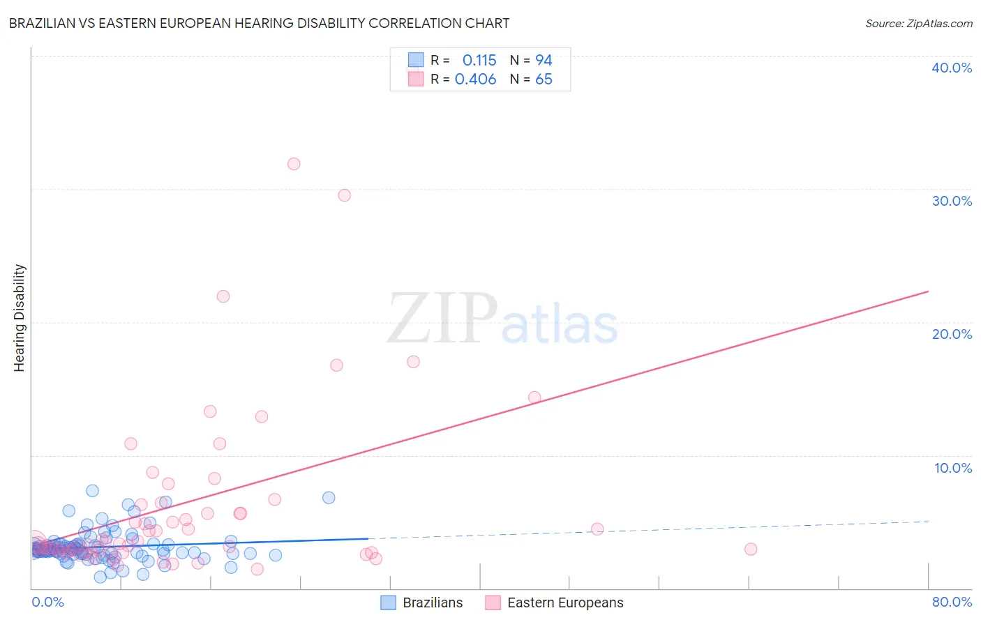Brazilian vs Eastern European Hearing Disability
