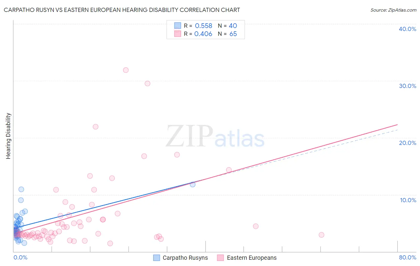 Carpatho Rusyn vs Eastern European Hearing Disability