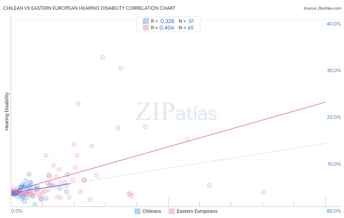 Chilean vs Eastern European Hearing Disability
