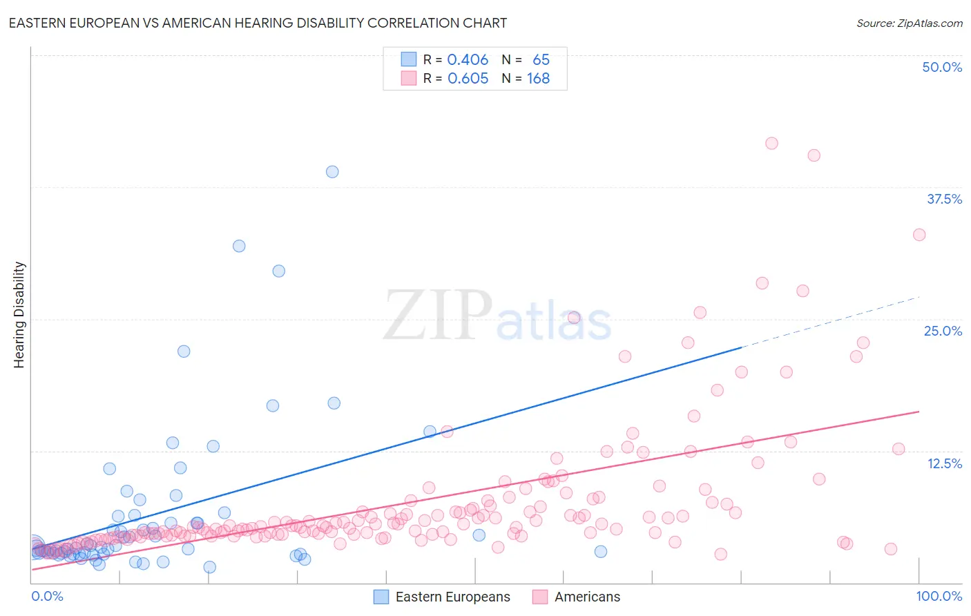 Eastern European vs American Hearing Disability