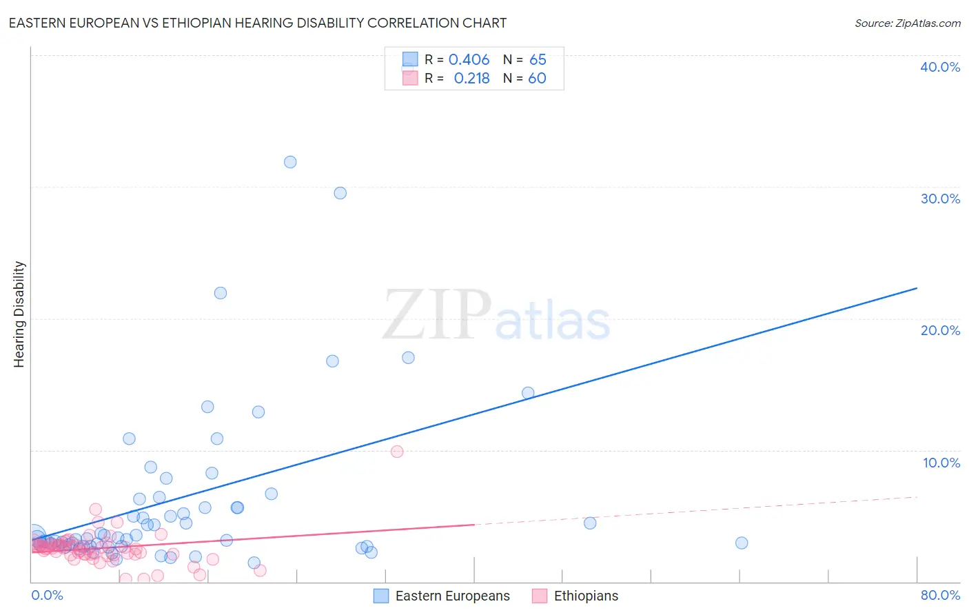 Eastern European vs Ethiopian Hearing Disability