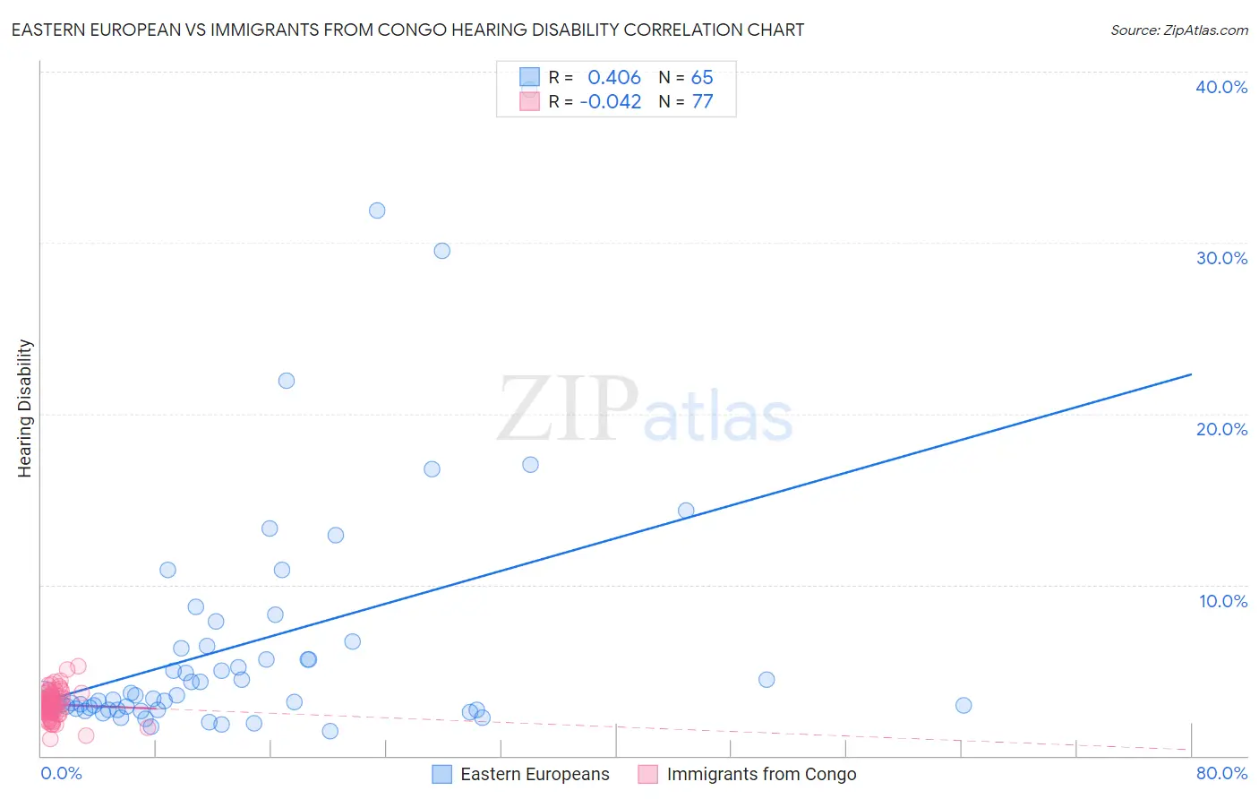 Eastern European vs Immigrants from Congo Hearing Disability