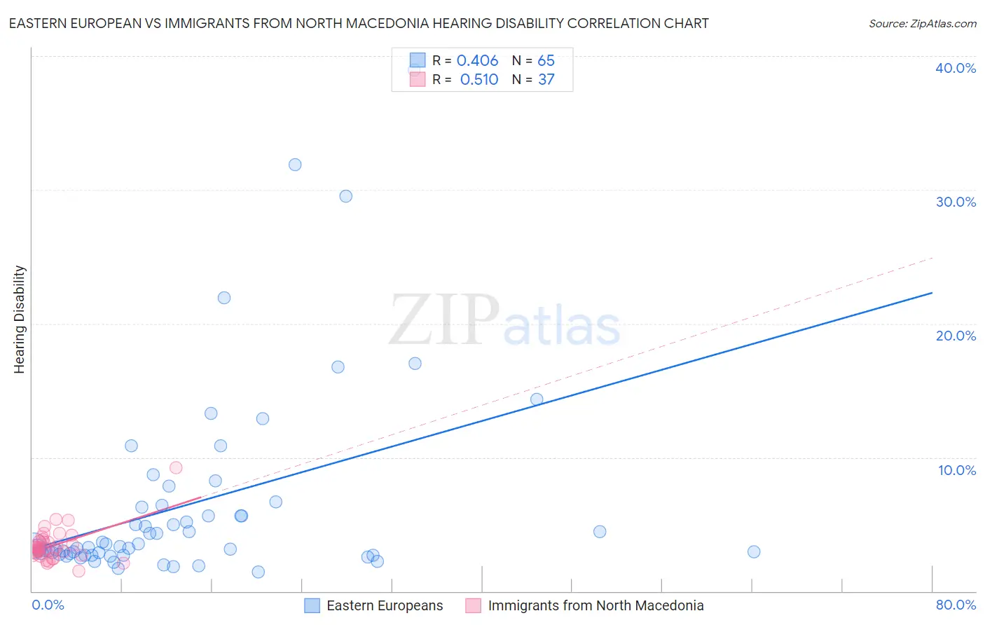 Eastern European vs Immigrants from North Macedonia Hearing Disability