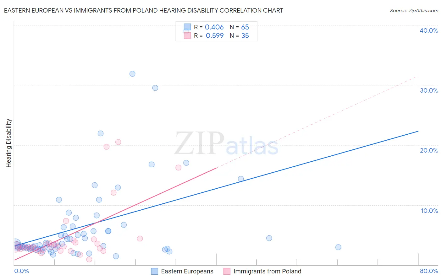 Eastern European vs Immigrants from Poland Hearing Disability