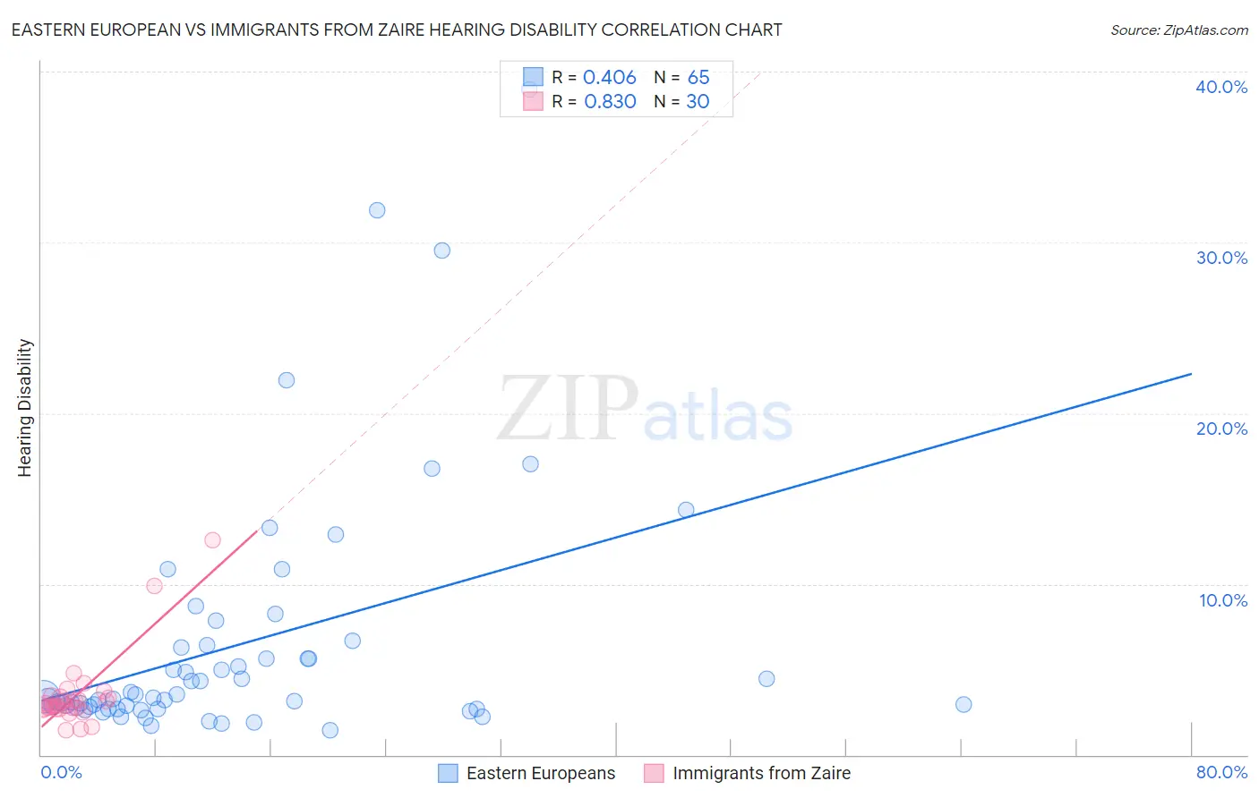 Eastern European vs Immigrants from Zaire Hearing Disability