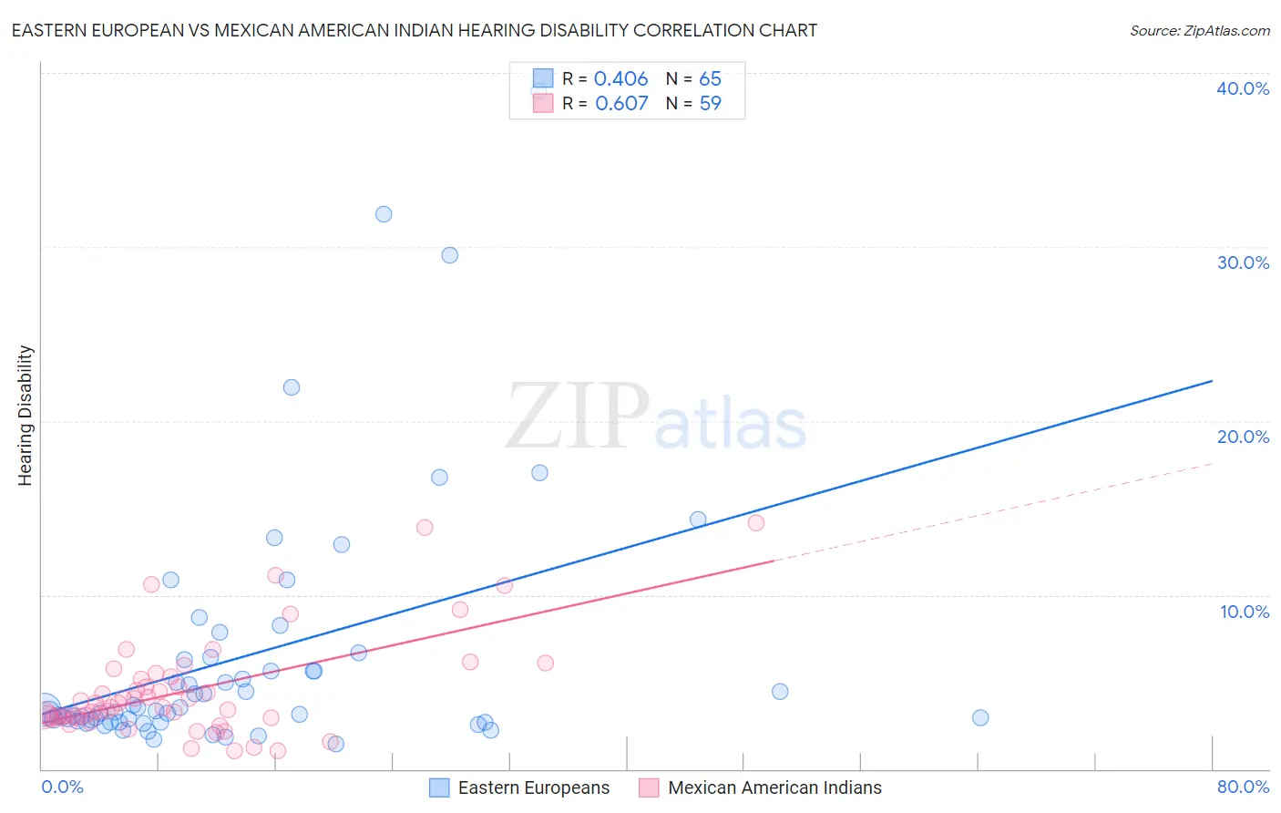 Eastern European vs Mexican American Indian Hearing Disability