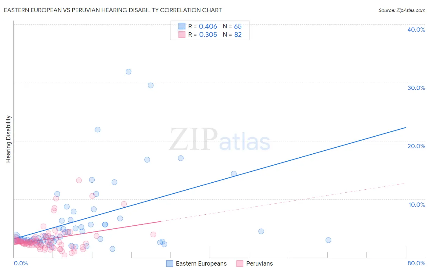 Eastern European vs Peruvian Hearing Disability
