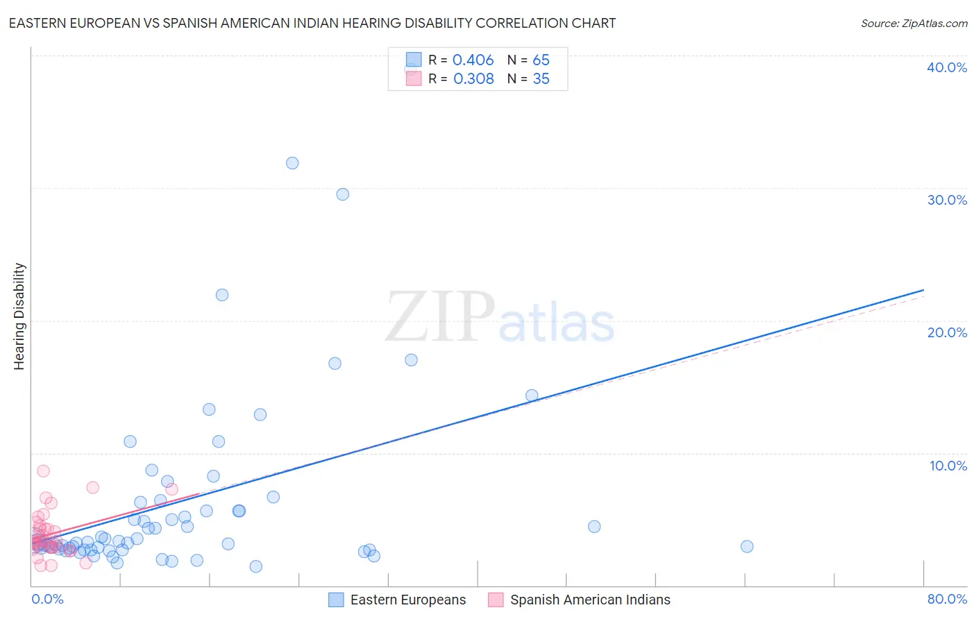 Eastern European vs Spanish American Indian Hearing Disability