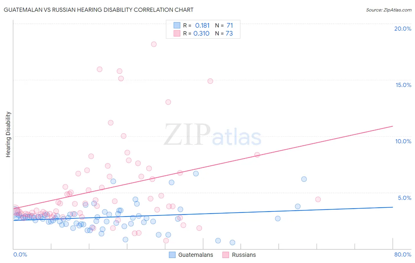 Guatemalan vs Russian Hearing Disability