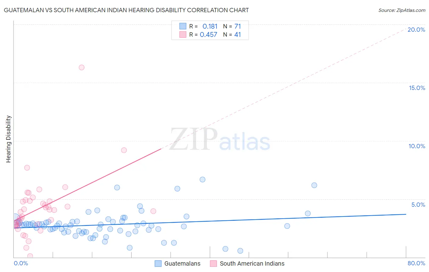 Guatemalan vs South American Indian Hearing Disability