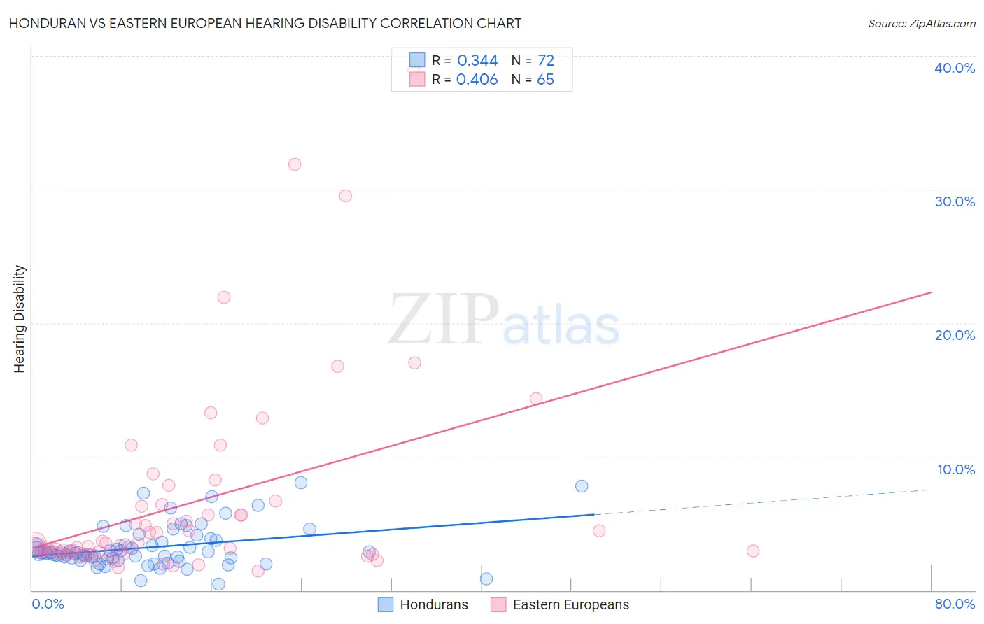 Honduran vs Eastern European Hearing Disability