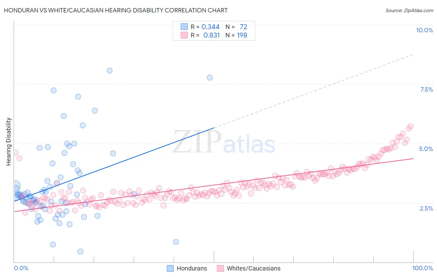 Honduran vs White/Caucasian Hearing Disability