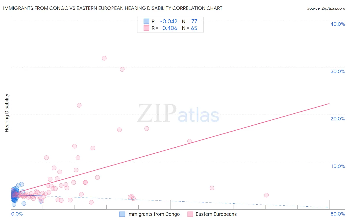Immigrants from Congo vs Eastern European Hearing Disability