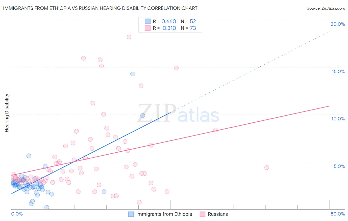 Immigrants from Ethiopia vs Russian Hearing Disability