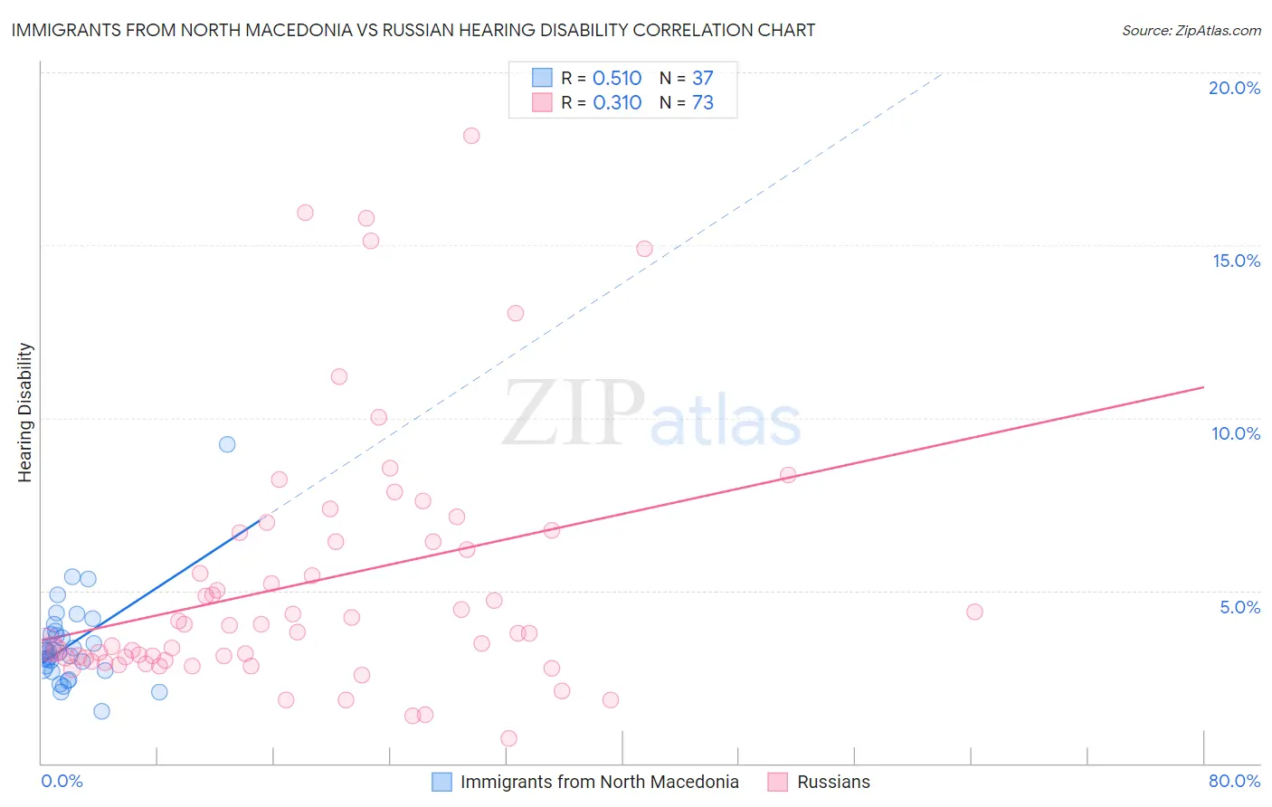 Immigrants from North Macedonia vs Russian Hearing Disability