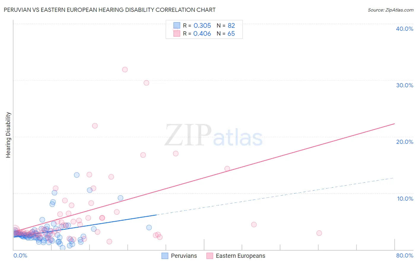 Peruvian vs Eastern European Hearing Disability