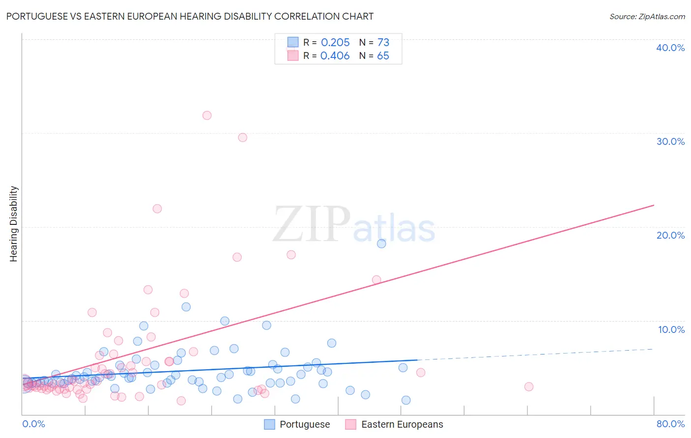 Portuguese vs Eastern European Hearing Disability