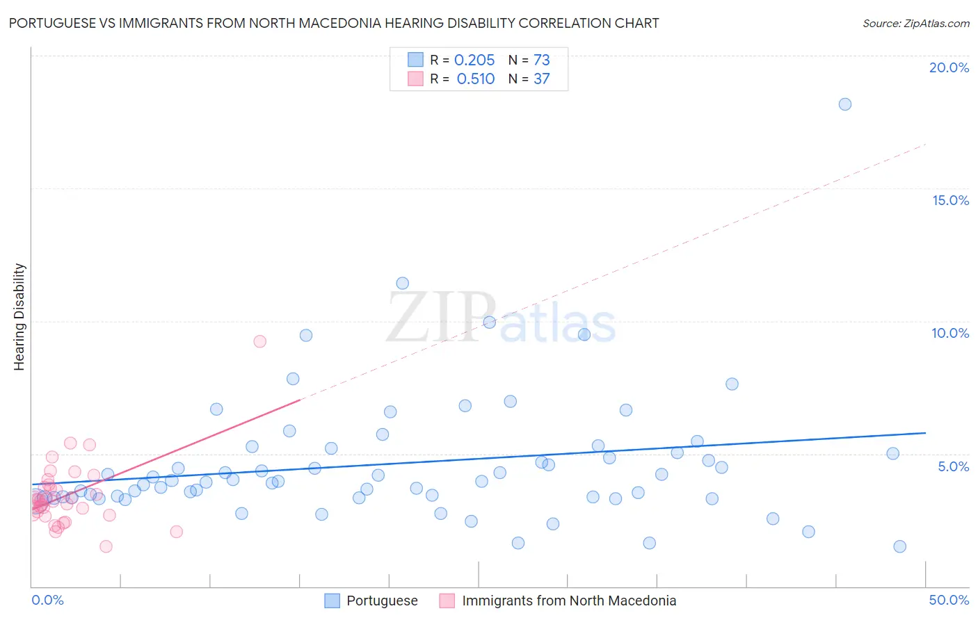 Portuguese vs Immigrants from North Macedonia Hearing Disability