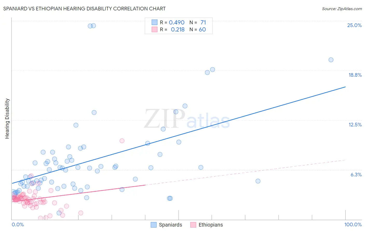 Spaniard vs Ethiopian Hearing Disability