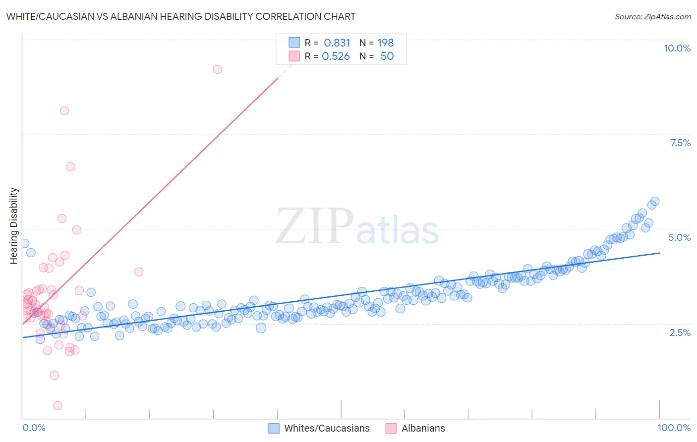White/Caucasian vs Albanian Hearing Disability