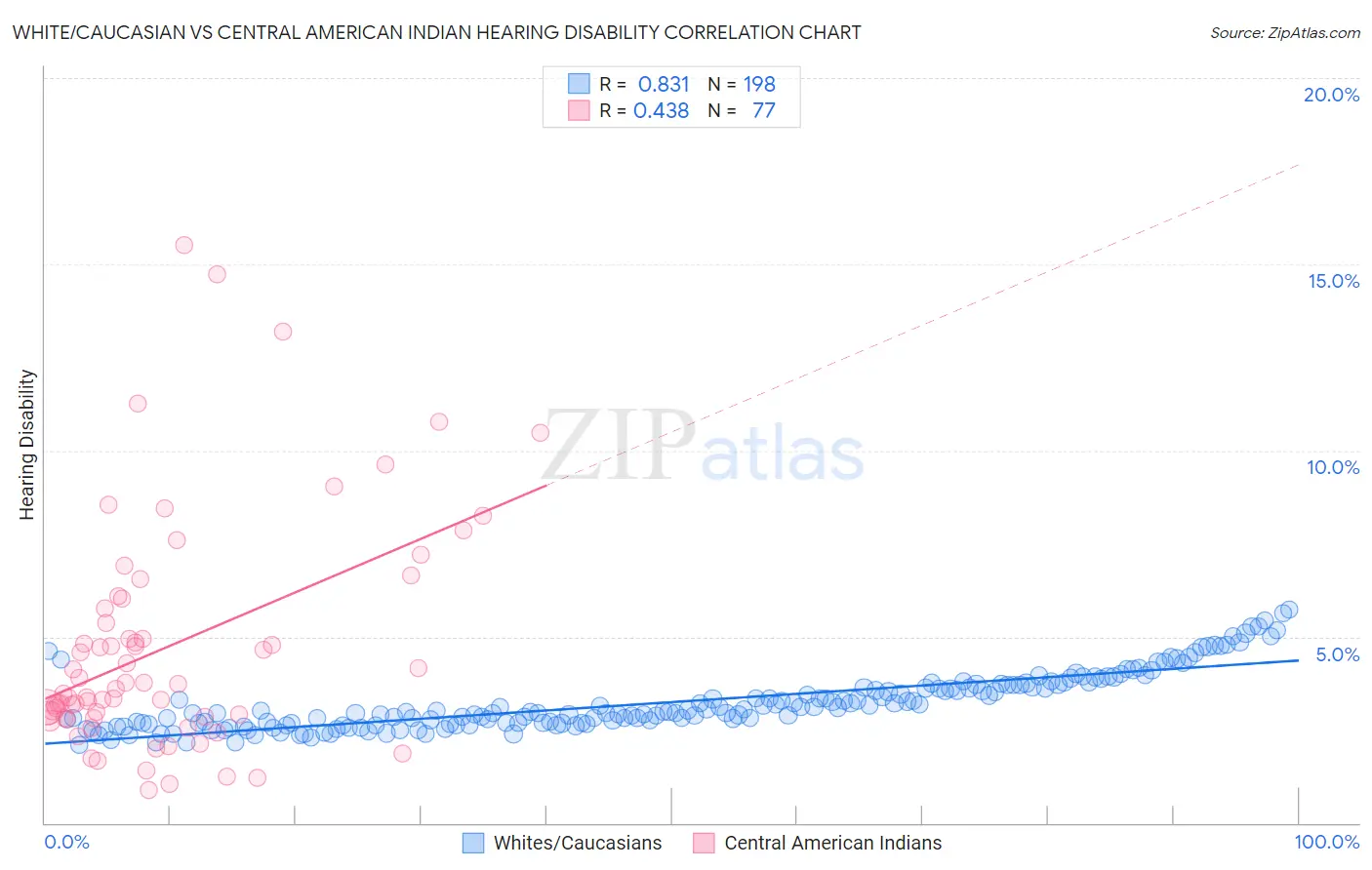 White/Caucasian vs Central American Indian Hearing Disability