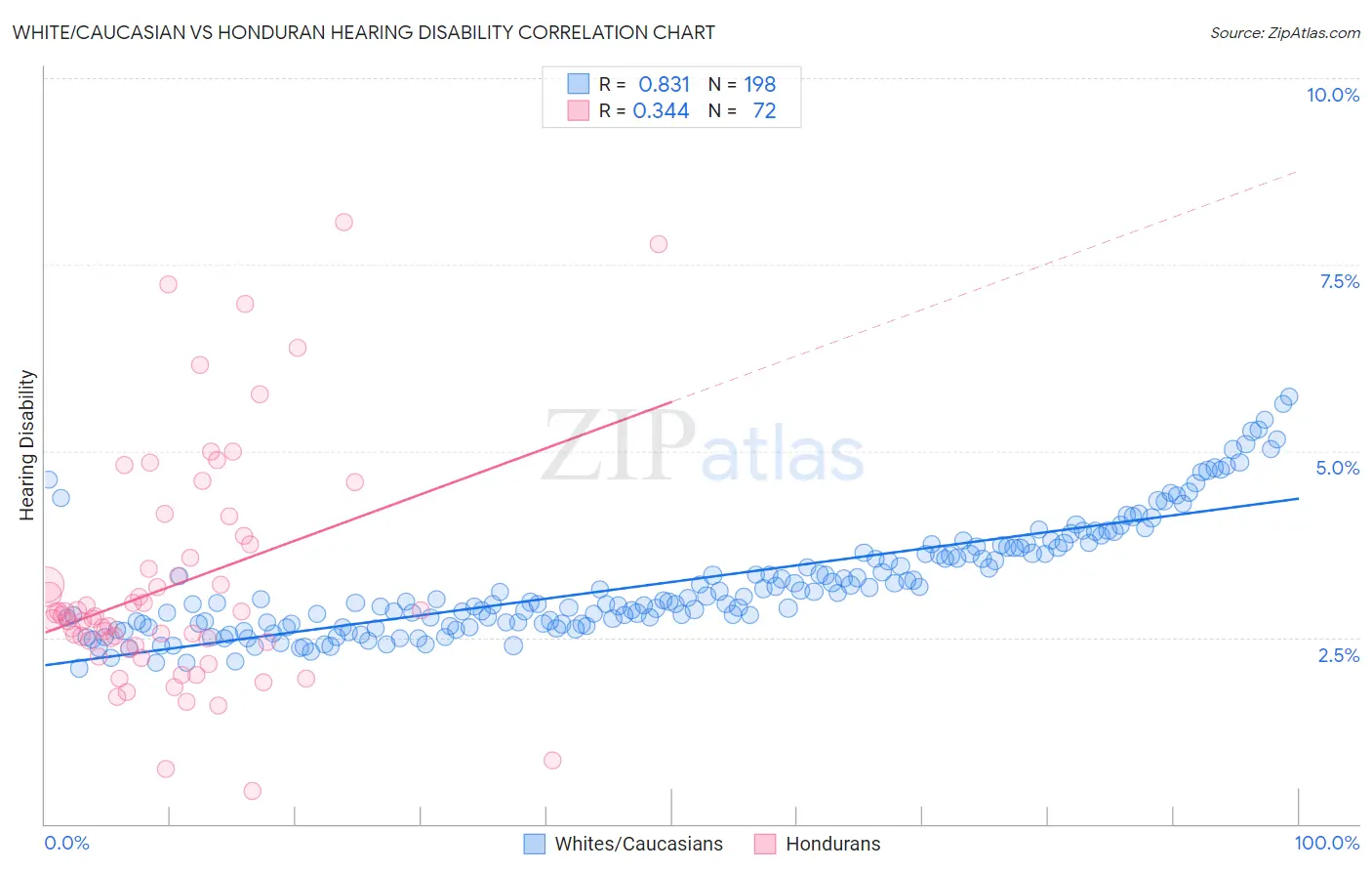 White/Caucasian vs Honduran Hearing Disability