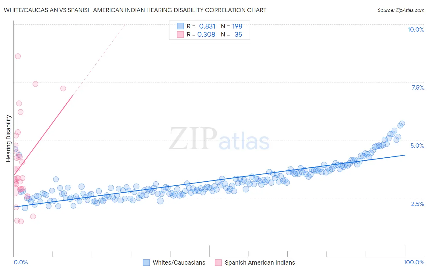 White/Caucasian vs Spanish American Indian Hearing Disability
