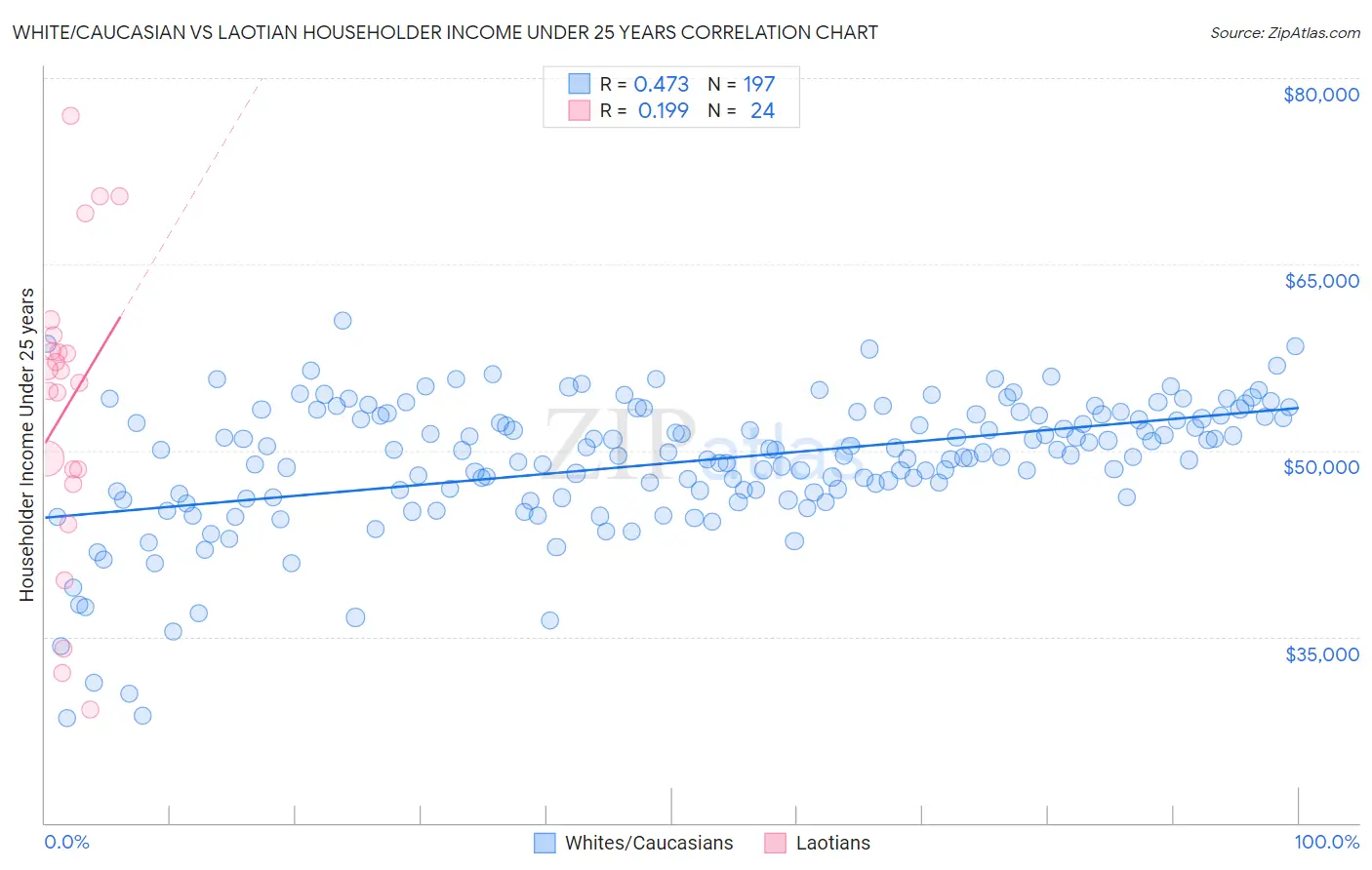White/Caucasian vs Laotian Householder Income Under 25 years