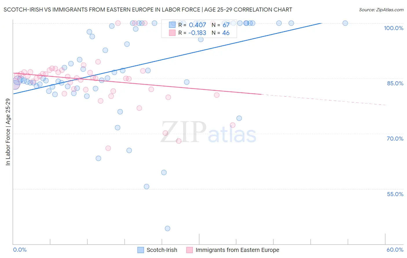 Scotch-Irish vs Immigrants from Eastern Europe In Labor Force | Age 25-29