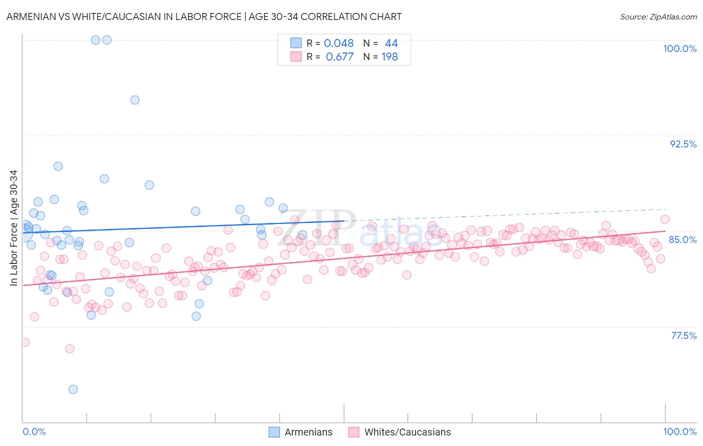 Armenian vs White/Caucasian In Labor Force | Age 30-34