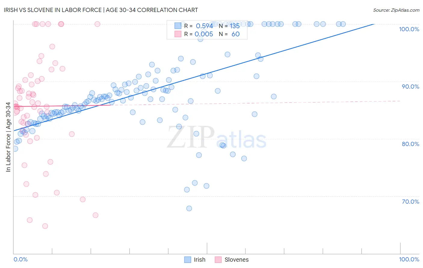 Irish vs Slovene In Labor Force | Age 30-34