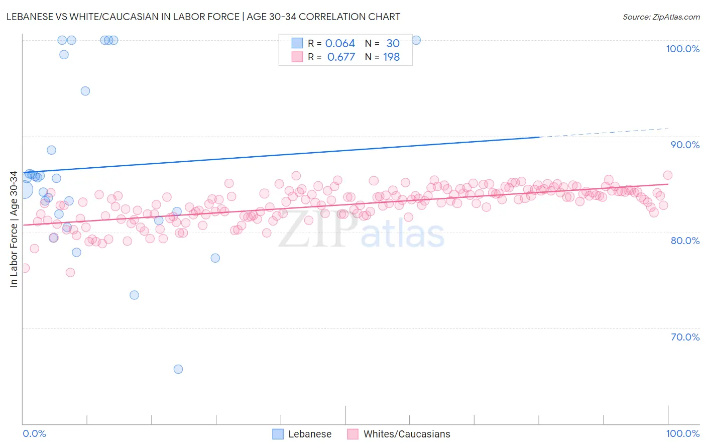 Lebanese vs White/Caucasian In Labor Force | Age 30-34