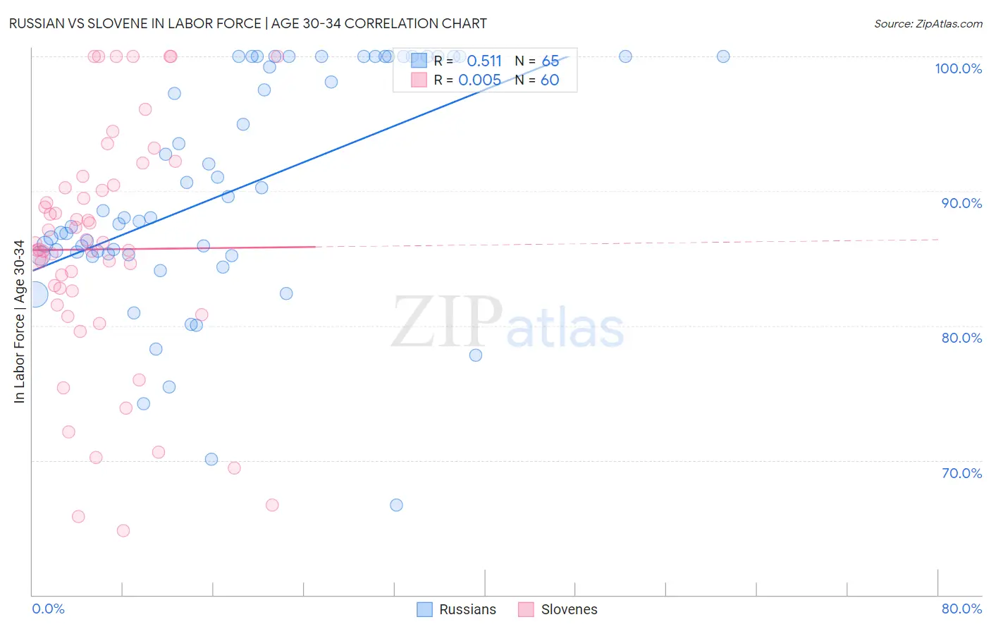 Russian vs Slovene In Labor Force | Age 30-34