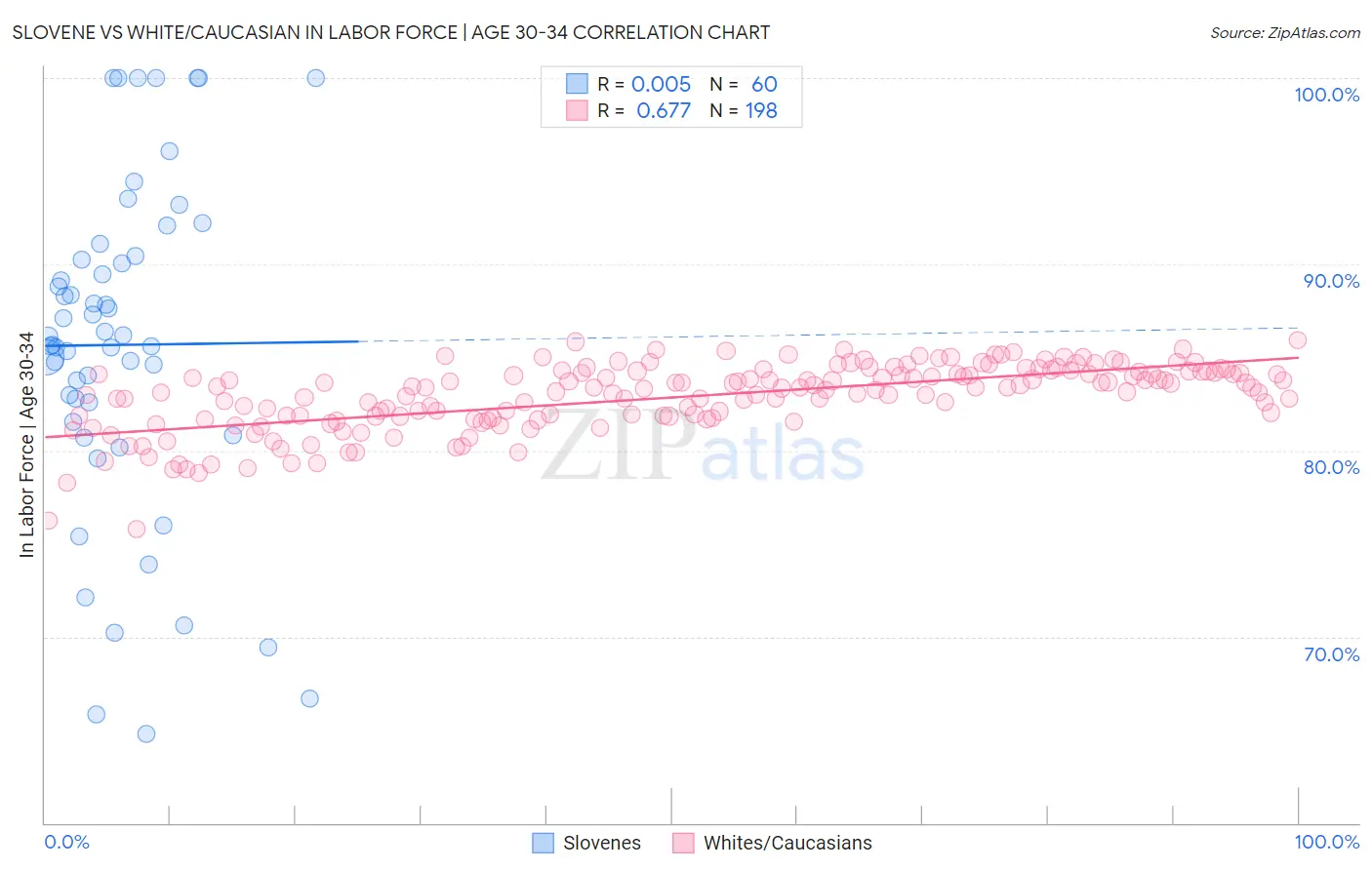 Slovene vs White/Caucasian In Labor Force | Age 30-34
