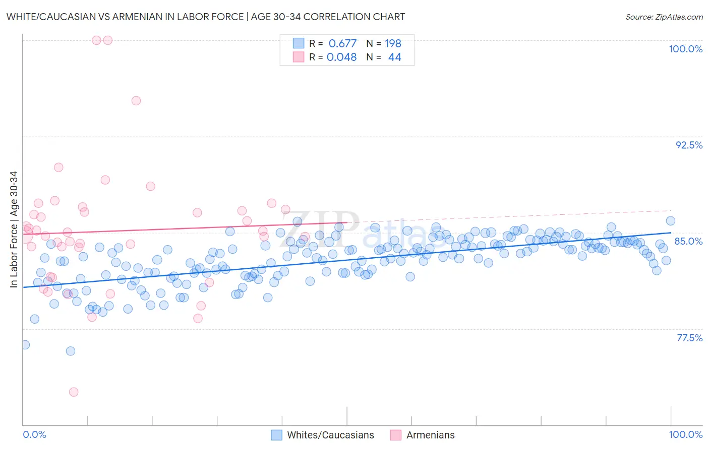White/Caucasian vs Armenian In Labor Force | Age 30-34