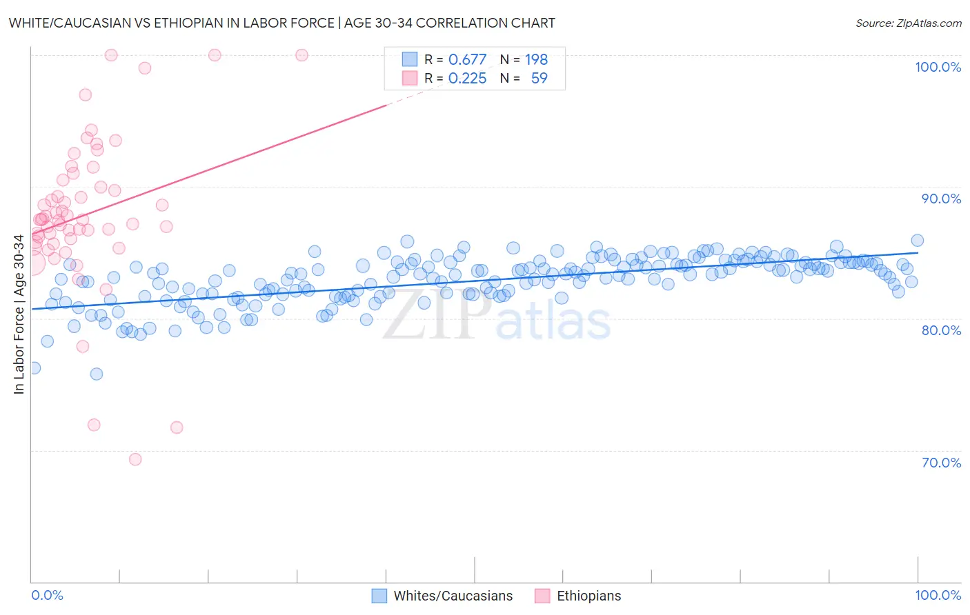 White/Caucasian vs Ethiopian In Labor Force | Age 30-34