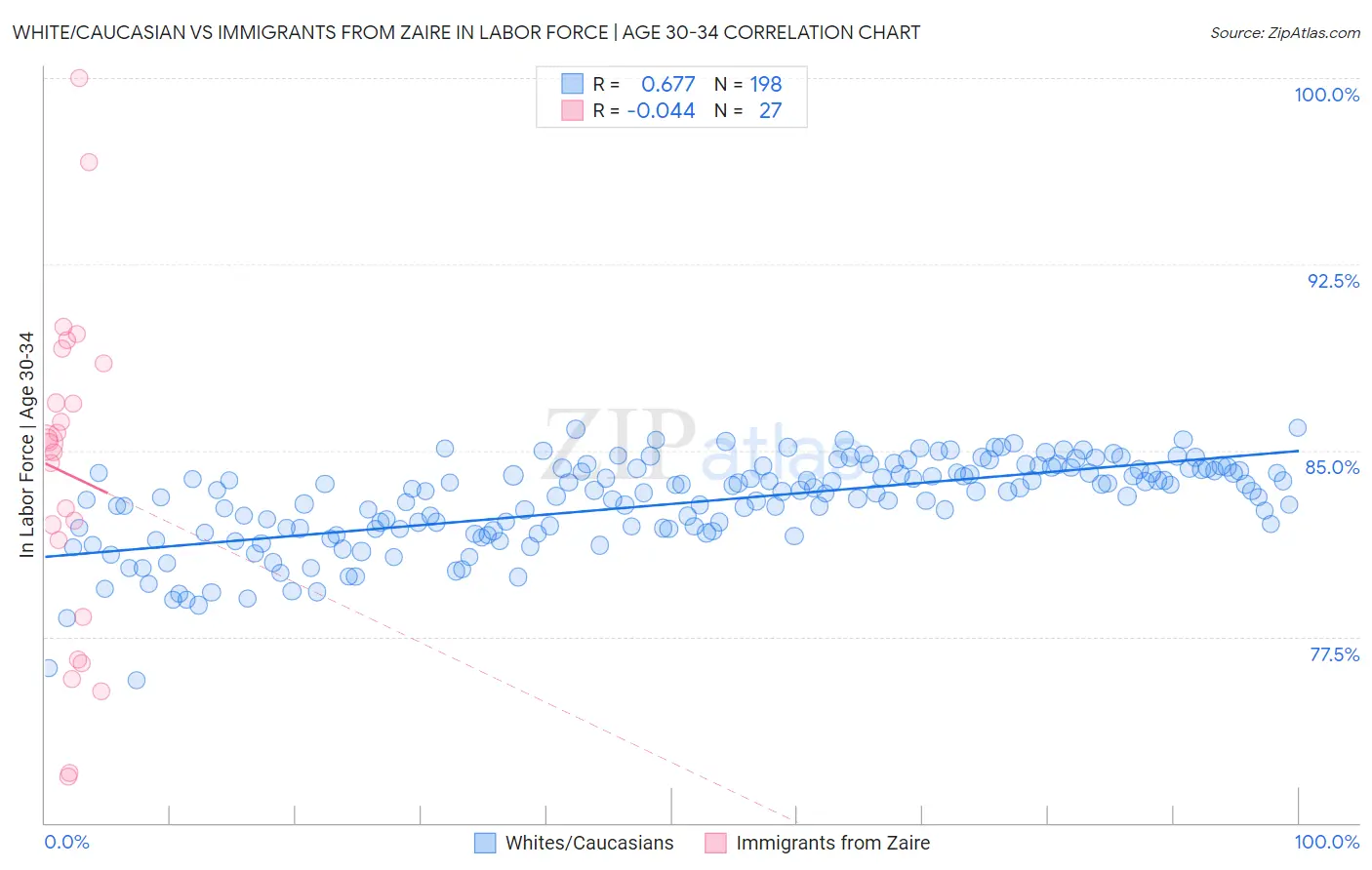 White/Caucasian vs Immigrants from Zaire In Labor Force | Age 30-34