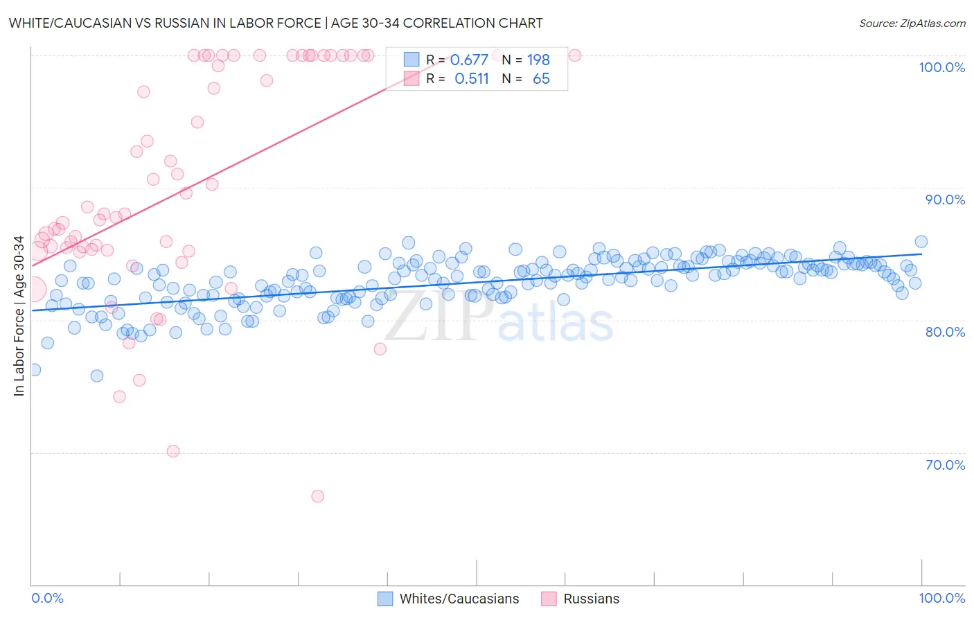White/Caucasian vs Russian In Labor Force | Age 30-34